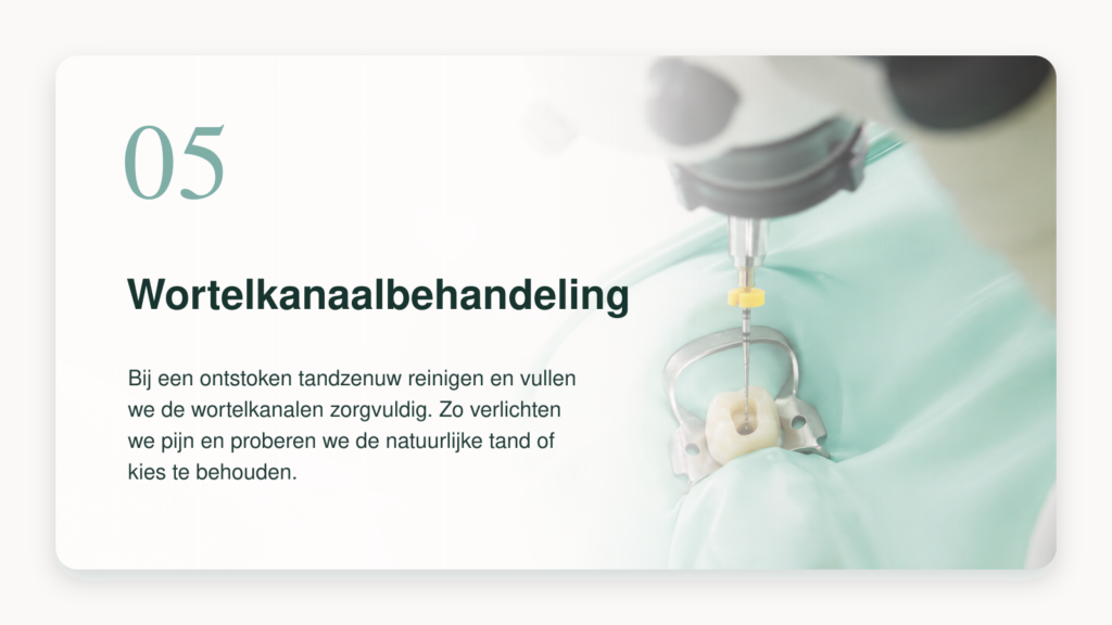 Wortelkanaalbehandeling bij BestDent