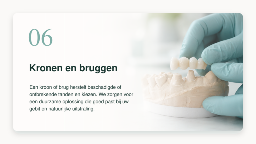 Kronen en bruggen bij BestDent