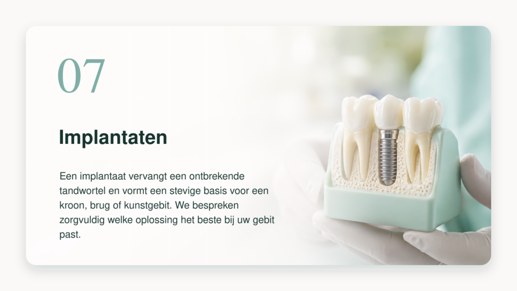Tandimplantaten bij BestDent