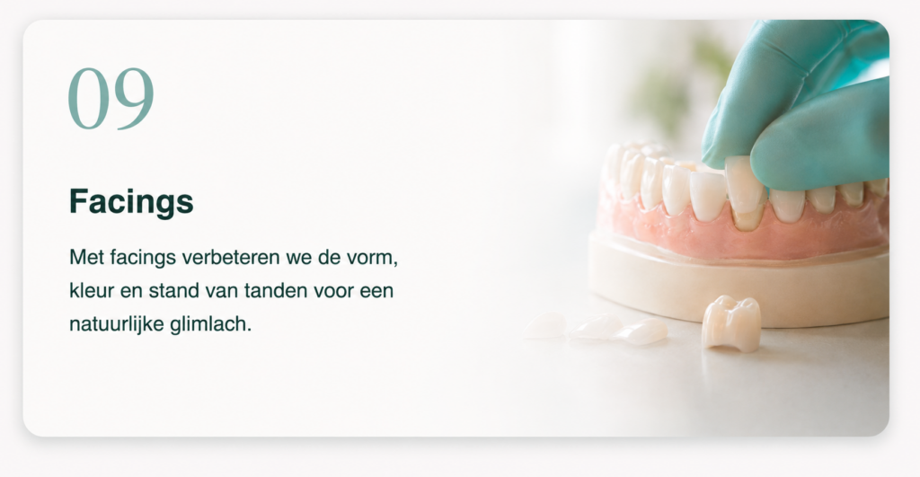 Facings bij BestDent